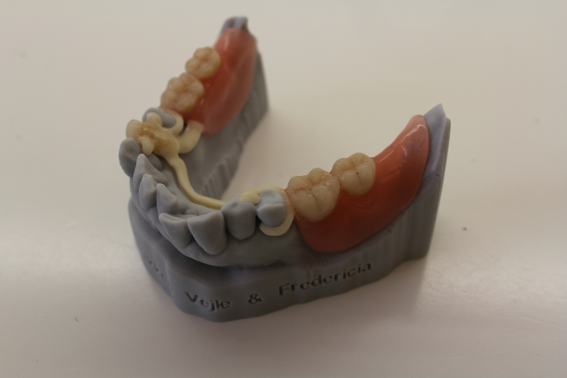 Dental model showing prosthetic structure